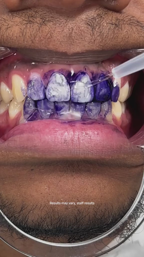 Load video: Hismile - Teeth Brightening Serum V34 (Original)
